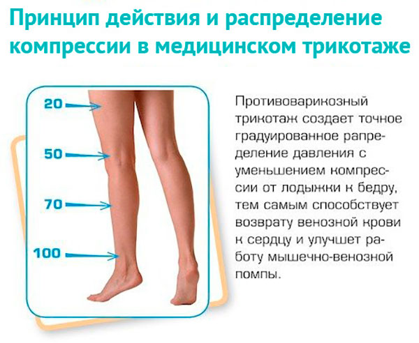 компрессионного трикотажа