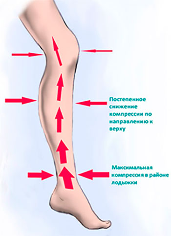 Особенности профилактики и лечения